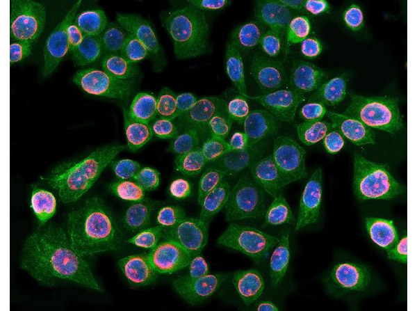 Immunofluorescence analysis of Lamin B1